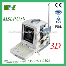 MSLPU30M 3D Full Digital Ultrasound Machine Protable Ultrasound diagnostic equipment